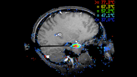 medical scan of human brain